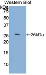 Western blot of recombinant ORM2 / Orosomucoid 2.