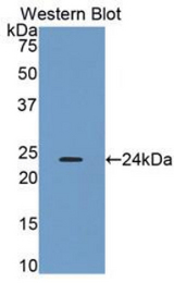 Western blot of recombinant ORM2 / Orosomucoid 2.