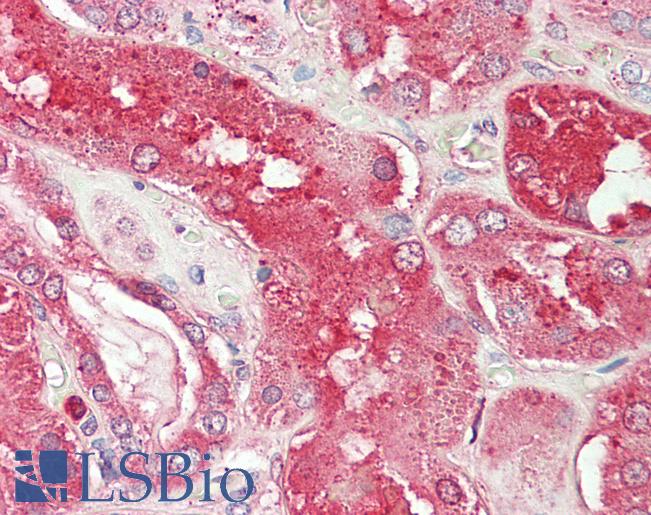 Anti-ORM2 / Orosomucoid 2 antibody IHC staining of human kidney. Immunohistochemistry of formalin-fixed, paraffin-embedded tissue after heat-induced antigen retrieval. Antibody LS-B11409 concentration 20 ug/ml.