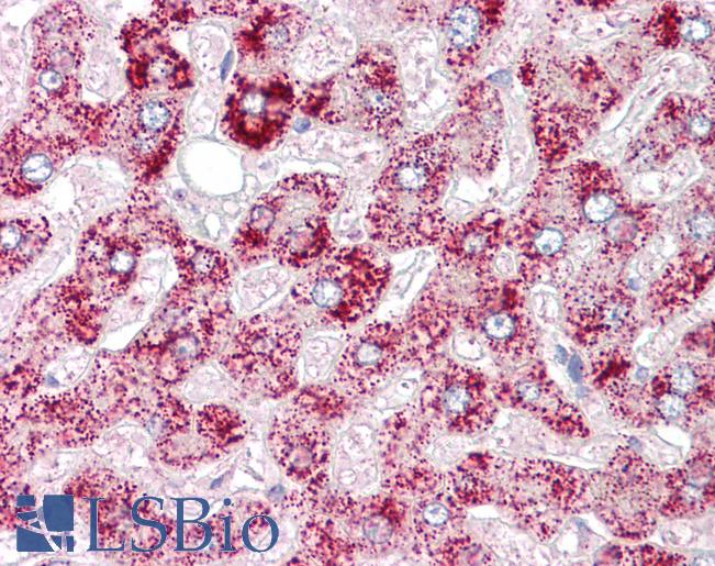 Anti-ORMDL1 antibody IHC of human liver. Immunohistochemistry of formalin-fixed, paraffin-embedded tissue after heat-induced antigen retrieval. Antibody LS-B7107 concentration 5 ug/ml.