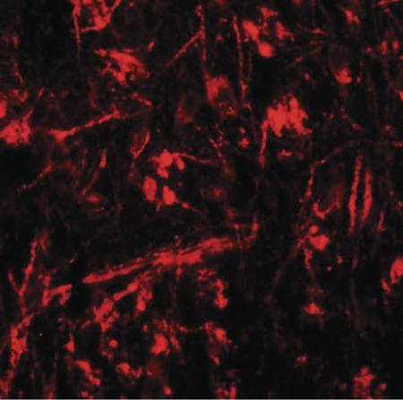 Immunofluorescence of ORMDL1 in mouse brain tissue with ORMDL1 antibody at 20 ug/ml.
