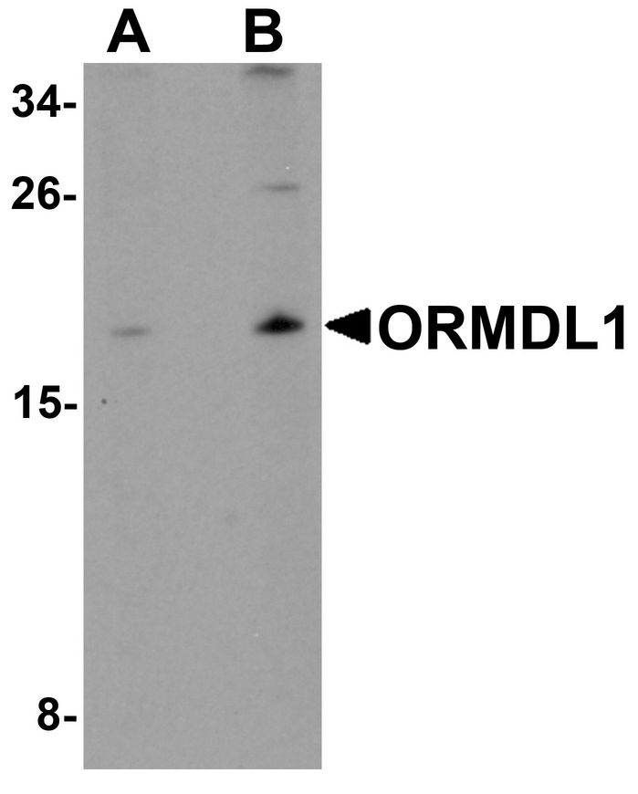 Western blot analysis of ORMDL1 in SK-N-SH Cell lysate with ORMDL1 antibody at (A) 1 ug/ml and (B) 2 ug/ml.