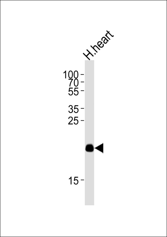 Western blot of lysate from human heart tissue lysate, using ORML2 Antibody. Antibody was diluted at 1:1000 at each lane. A goat anti-rabbit IgG H&L (HRP) at 1:5000 dilution was used as the secondary antibody. Lysate at 35ug per lane.