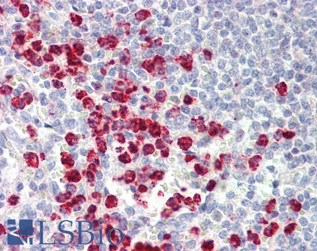 Anti-ORMDL3 antibody IHC staining of human spleen. Immunohistochemistry of formalin-fixed, paraffin-embedded tissue after heat-induced antigen retrieval. Antibody LS-B9583 dilution 1:100.