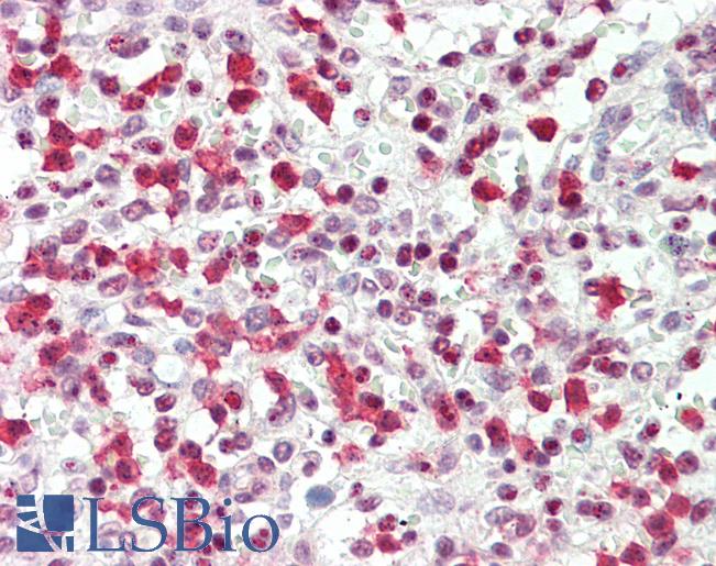 Anti-OS9 antibody IHC staining of human spleen. Immunohistochemistry of formalin-fixed, paraffin-embedded tissue after heat-induced antigen retrieval. Antibody LS-B10208 concentration 5 ug/ml.