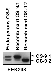 Detection of OS-9.1 and OS-9.2 in total HEK293 cells, HEK293 cells expressing OS-9.1 or OS-9.2 by western analysis.