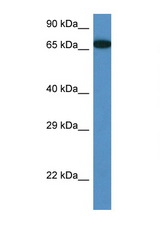 MBTD1 antibody LS-C145226 Western blot of Mouse Pancreas lysate. Antibody concentration 1 ug/ml.
