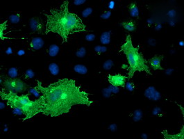 Anti-OSBP mouse monoclonal antibody immunofluorescent staining of COS7 cells transiently transfected by pCMV6-ENTRY OSBP.