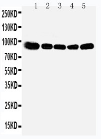 WB of OSBP antibody. Lane 1: Rat Kidney Tissue Lysate. Lane 2: Rat Spleen Tissue Lysate. Lane 3: Rat Lung Tissue Lysate. Lane 4: HELA Cell Lysate. Lane 5: A549 Cell Lysate.