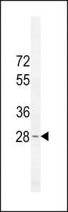 METTL10 Antibody western blot of HL-60 cell line lysates (35 ug/lane). The METTL10 antibody detected the METTL10 protein (arrow).