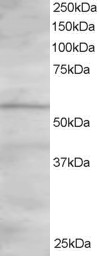 Antibody staining (1.5 ug/ml) of Human Heart lysate (RIPA buffer, 30 ug total protein per lane). Primary incubated for 1 hour. Detected by Western blot of chemiluminescence.