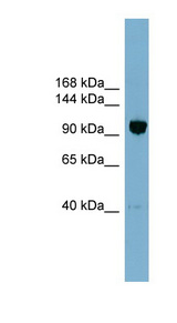 OSBPL8 antibody LS-C110946 Western blot of OVCAR-3 cell lysate.
