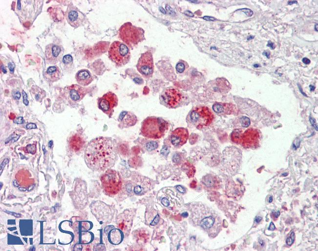 Anti-OSBPL9 antibody IHC of human lung, alveolar macrophages. Immunohistochemistry of formalin-fixed, paraffin-embedded tissue after heat-induced antigen retrieval. Antibody LS-B3598 concentration 2.5 ug/ml.