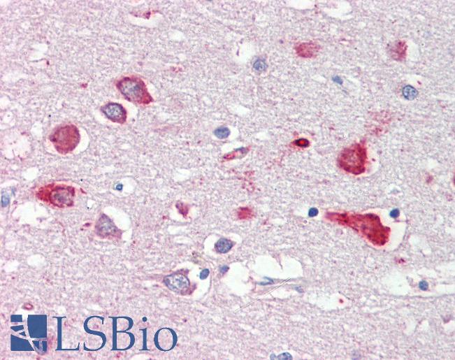 Anti-OSBPL9 antibody IHC of human brain, cortex. Immunohistochemistry of formalin-fixed, paraffin-embedded tissue after heat-induced antigen retrieval. Antibody LS-B3598 concentration 2.5 ug/ml.