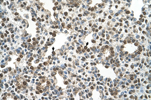 OSBPL9 antibody LS-C40529 IHC of formalin-fixed, paraffin-embedded human Lung. Positive label: Alveolar cells indicated with arrows. Antibody concentration 4-8 ug/ml. Magnification 400X.