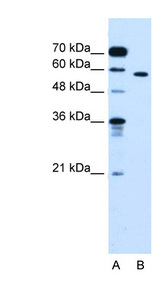 OSBPL9 antibody LS-C40529 Western blot of Jurkat lysate.