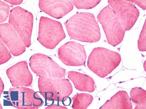 Anti-OSBPL9 antibody IHC staining of human skeletal muscle. Immunohistochemistry of formalin-fixed, paraffin-embedded tissue after heat-induced antigen retrieval.