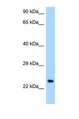 OSCAR antibody LS-C146063 Western blot of Jurkat Cell lysate. Antibody concentration 1 ug/ml.