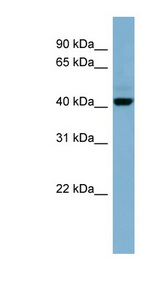 OSCP1 / NOR1 antibody LS-C115940 Western blot of NCI-H226 cell lysate.
