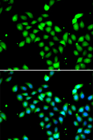 Immunofluorescence blot of A549 cell using METTL13 antibody. Blue: DAPI for nuclear staining.