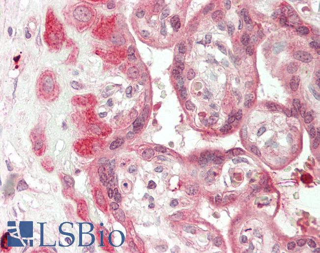 Human Placenta: Formalin-Fixed, Paraffin-Embedded (FFPE)