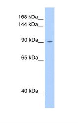 HT1080 cell lysate. Antibody concentration: 1.0 ug/ml. Gel concentration: 8%.