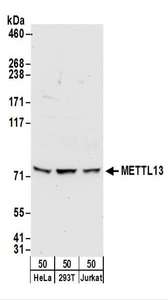 Detection of Human METTL13 by Western Blot. Samples: Whole cell lysate (50 ug) from HeLa, 293T, and Jurkat cells. Antibodies: Affinity purified rabbit anti-METTL13 antibody used for WB at 0.4 ug/ml. Detection: Chemiluminescence with an exposure time of 30 seconds.