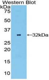 Western blot of recombinant OSMR.