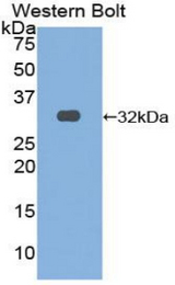 Western blot of recombinant OSMR.