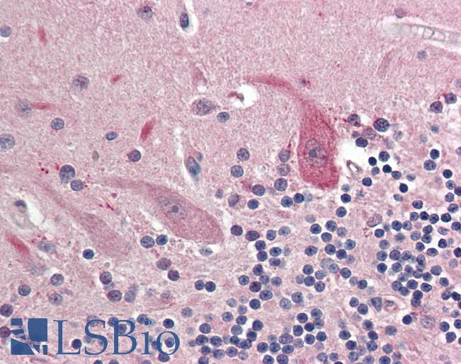 Anti-OSMR antibody IHC staining of human brain, cerebellum. Immunohistochemistry of formalin-fixed, paraffin-embedded tissue after heat-induced antigen retrieval. Antibody LS-B11477 concentration 10 ug/ml.