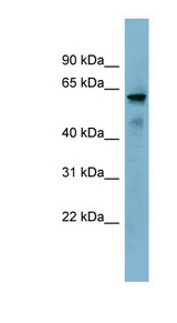 METTL14 antibody LS-C107729 Western blot of NCI-H226 cell lysate.