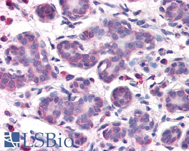 Anti-OSTC antibody LS-A9861 IHC of human breast. Immunohistochemistry of formalin-fixed, paraffin-embedded tissue after heat-induced antigen retrieval.