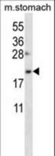 OSTC Antibody western blot of mouse stomach tissue lysates (35 ug/lane). The OSTC antibody detected the OSTC protein (arrow).