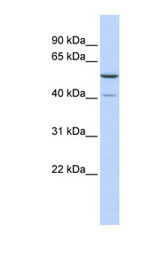 METTL15 / METT5D1 antibody LS-C102329 Western blot of Fetal Brain lysate.