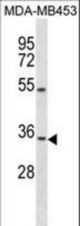 OSTM1 Antibody western blot of MDA-MB453 cell line lysates (35 ug/lane). The OSTM1 Antibody detected the OSTM1 protein (arrow).