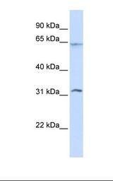 Jurkat cell lysate. Antibody concentration: 1.0 ug/ml. Gel concentration: 12%.