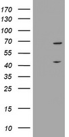 HEK293T cells were transfected with the pCMV6-ENTRY control (Left lane) or pCMV6-ENTRY METT10D (Right lane) cDNA for 48 hrs and lysed. Equivalent amounts of cell lysates (5 ug per lane) were separated by SDS-PAGE and immunoblotted with anti-METT10D.