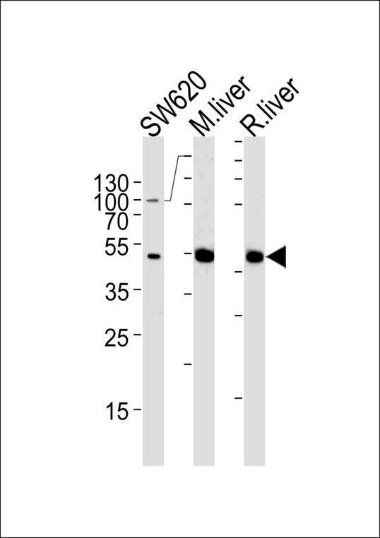 OTC Antibody western blot of SW620 cell line and mouse liver, rat liver lysates (35 ug/lane). The OTC antibody detected the OTC protein (arrow).