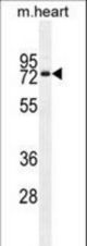 OTOP1 Antibody western blot of mouse heart tissue lysates (35 ug/lane). The OTOP1 antibody detected the OTOP1 protein (arrow).