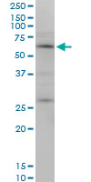 OTOP2 monoclonal antibody (M10), clone 4F6. Western blot of OTOP2 expression in MCF-7.