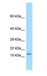 OTOS antibody Western Blot of Mouse Pancreas.