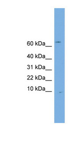 OTOS antibody LS-C116522 Western blot of Jurkat lysate.