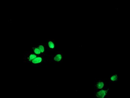Anti-METT10D mouse monoclonal antibody immunofluorescent staining of COS7 cells transiently transfected by pCMV6-ENTRY METT10D.