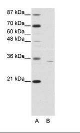 A: Marker, B: Jurkat Cell Lysate
