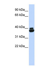 OTP antibody LS-C101509 Western blot of Fetal Heart lysate.