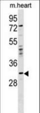 OTP Antibody western blot of mouse heart tissue lysates (35 ug/lane). The OTP antibody detected the OTP protein (arrow).
