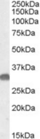Antibody (0.05 ug/ml) staining of Mouse Brain lysate (35 ug protein in RIPA buffer). Primary incubation was 1 hour. Detected by chemiluminescence