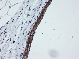 IHC of paraffin-embedded Human bladder tissue using anti-OTUB1 mouse monoclonal antibody. (Heat-induced epitope retrieval by 10mM citric buffer, pH6.0, 100C for 10min).
