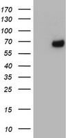 HEK293T cells were transfected with the pCMV6-ENTRY control (Left lane) or pCMV6-ENTRY METT10D (Right lane) cDNA for 48 hrs and lysed. Equivalent amounts of cell lysates (5 ug per lane) were separated by SDS-PAGE and immunoblotted with anti-METT10D.
