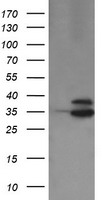 HEK293T cells were transfected with the pCMV6-ENTRY control (Left lane) or pCMV6-ENTRY OTUB1 (Right lane) cDNA for 48 hrs and lysed. Equivalent amounts of cell lysates (5 ug per lane) were separated by SDS-PAGE and immunoblotted with anti-OTUB1.